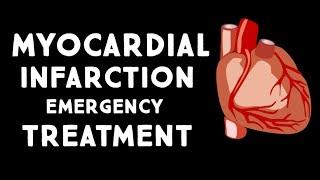 Myocardial Infarction (MI,Heart Attack) Treatment in Emergency | Step wise  STEMI Management USMLE