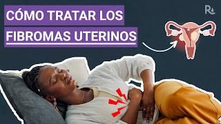 Fibromas uterinos: ¿Cuáles son los síntomas y las opciones de tratamiento?