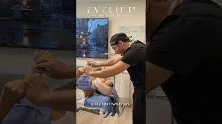 EVE Lift™ Patient Results With Dr. Ali Charafeddine | Eden Plastic Surgery: Dr. Ali Charafeddine, MD