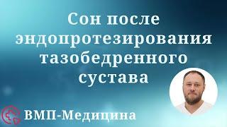 Как можно спать после эндопротезирования тазобедренного сустава дома после операции | ВМП-Медицина