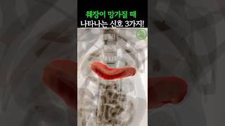 췌장이 망가질 때 나타나는 신호 3가지! 절대 무시하지 마세요. #건강 #건강정보