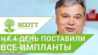 Имплантация зубов отзывы.  Отзыв пациента об однофазной имплантации зубов. ROOTT.