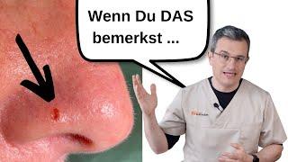 ... musst Du zum Hautarzt. HAUTKREBS nicht ausgeschlossen. TEIL 1. Dr. Kasten Hautmedizin in Mainz