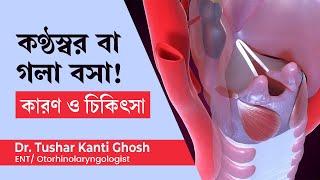 কন্ঠস্বর বা গলা বসে যাওয়ার কারণ ও চিকিৎসা | Hoarseness of voice Causes & treatment in Bengali