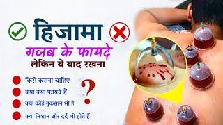 Hijama क्या होता है | कब कैसे और किन लोगों को कराना चाहिए | Hijama (Cupping therapy) ke fayde