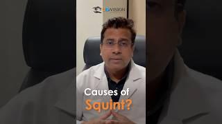 Causes Of Squint explained by Dr. Deepak Goyal | 3D Vision Eye Hospital #causesofsquint #squint