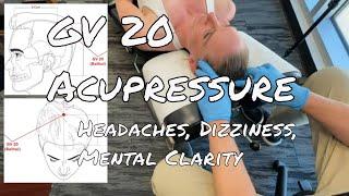 GV 20 Acupressure: Headaches, Dizziness, Mental Clarity