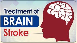 Treatment of Brain Stroke | Paralysis Patient Brain Treatment | SRIAAS