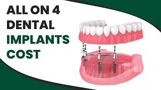 All On 4 Dental Implants Cost