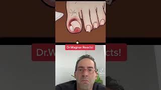 ASMR INGROWN TOENAIL REMOVAL  #shorts #asmr #ingrowntoenail