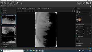 How to Label the Full-Mouth Dental X-Rays using the iM3 Software