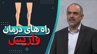 عوامل ایجاد واریس و درمان آن | گفتگو با جراح عمومی