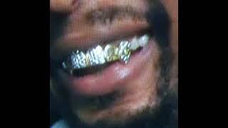 [FREE] Asap Rocky x JID x Kendrick Lamar Type Beat | “Teeth“