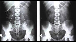 Abdomen - Radiographic Positioning