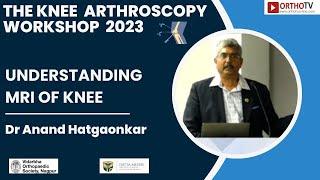 Understanding MRI of Knee :  Dr Anand Hatgaonkar