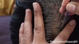 Scratching Dandruff of scalp