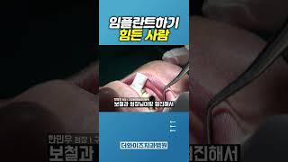 보철과 원장님과 협진이 필요한 경우는?... #임플란트 #치과의사 #치과 #dentist