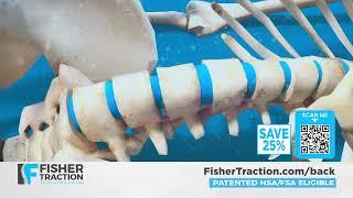 Quick And Easy Lower Back Pain Relief At Home With Fisher Traction | FisherTraction.com