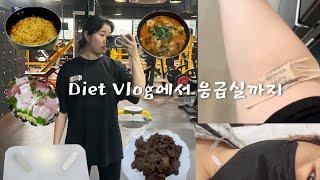 Diet Vlog l 1일1식 먹고싶은거 다먹고 응급실까지