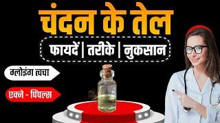 चंदन के तेल के हैरान कर देने वाले फायदें ? Sandalwood Oil Benefits, Chandan ke Tel ke Fayden