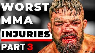 The SHOCKING Reality of MMA Injuries: When the Octagon Breaks You