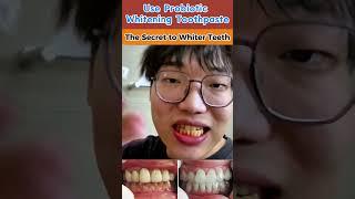 BodyAccel-Triple Whitening Niacinamide Whitening Toothpaste