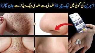 How to Remove Blackheads Permanently From Your Nose & Face Instantly |Naturaly at Home|No Whitehead