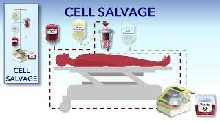 Cell Salvage and Hemodilution