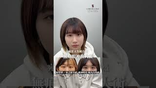 案例分享：無痕雙眼皮手術+開眼頭手術 ｜晶華美醫診所、晶心美醫集團｜中山整形外科診所