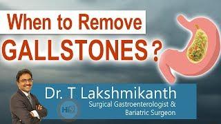 When to remove Gallstones | What are Gallstones | Gallbladder |Dr.T.Lakshmikanth |Gastroenterologist