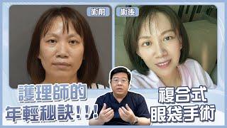 眼袋消除! 護理師變年輕秘訣: 複合式眼袋手術!｜林敬鈞醫師｜巨星整形外科