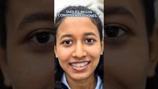 smiles begin confidence shines."#orthodontics #trending #youtube #shorts #tooth