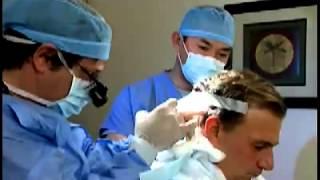 Hair Transplant Chicago - Dr. Richard Keller - NSHTS