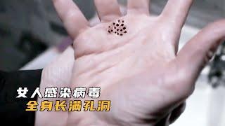 【悟空】女人感染不明病毒，全身長滿孔洞，細思極恐的驚悚片