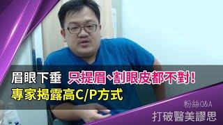 眉眼下垂該提眉還是割雙眼皮？　隱痕強效但不猙獰的提眉眼尾改良技術新提案 打破醫美謬思 165-20200911