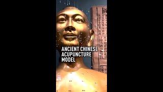 Ancient Chinese acupuncture model