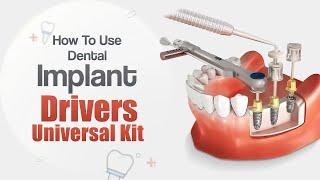 How to use Dental Implant Prosthetic Universal Kit with 16 drivers #dentalimplant #implantdenture