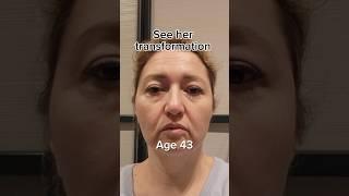 See her transformation | Face Fitness | Face Yoga | Facial Massage
