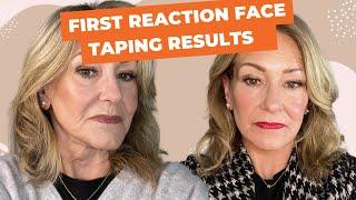 Face Taping Before and After: A Step-by-Step Guide and is it Right for you?