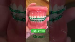 Light Green BRACES ,tooth vlog #orthodontics#viral #shorts#braces