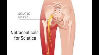 From Pain to Relief: Harnessing Nutraceuticals for Sciatica