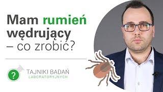 Mam rumień wędrujący – co robić? [HD]