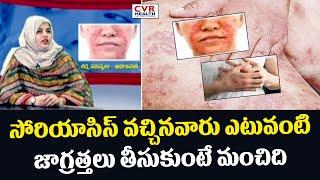 సోరియాసిస్ వచ్చినవారు ఎటువంటి జాగ్రత్తలు తీసుకుంటే మంచిది | What Precautions Taken with Psoriasis