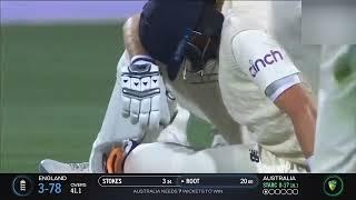 Joe Root Injury In Ashes 2021 | Joe Root Painful Video | Aus vs Eng Ashes