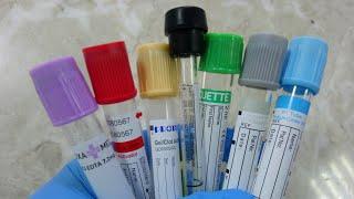 Sample collection tubes used in laboratory.