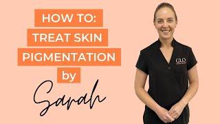 How To: Treat Skin Pigmentation