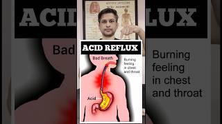 Exercise for Reduce Acid Reflux #shorts