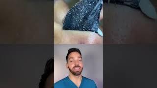 Doctor Reacts to Satisfying Pore Strips #shorts