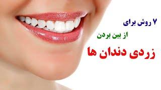 از بین بردن زردی دندان ها با 7 روش خانگی