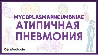 Атипичная пневмония - Микоплазма пневмонии (M.pneumoniae) - клиника, диагностика, лечение